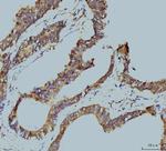 PSMC3 Antibody in Immunohistochemistry (Paraffin) (IHC (P))