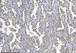 PMPCB Antibody in Immunohistochemistry (Paraffin) (IHC (P))