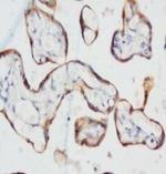 pan Keratin Antibody in Immunohistochemistry (Paraffin) (IHC (P))