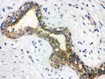 alpha Actinin 2 Antibody in Immunohistochemistry (Paraffin) (IHC (P))