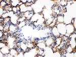 alpha Actinin 2 Antibody in Immunohistochemistry (Paraffin) (IHC (P))