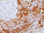 Galectin 9 Antibody in Immunohistochemistry (Paraffin) (IHC (P))