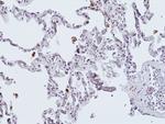 Galectin 9 Antibody in Immunohistochemistry (Paraffin) (IHC (P))