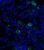 PD-L1 Antibody in Immunocytochemistry (ICC/IF)