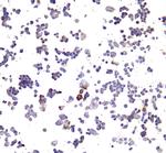 PD-L1 Antibody in Immunocytochemistry (ICC/IF)