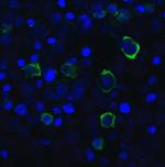 TIGIT Antibody in Immunocytochemistry (ICC/IF)