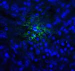 TIGIT Antibody in Immunohistochemistry (Paraffin) (IHC (P))