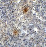 TIGIT Antibody in Immunohistochemistry (Paraffin) (IHC (P))