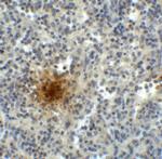 TIGIT Antibody in Immunohistochemistry (Paraffin) (IHC (P))