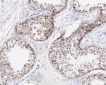 CRBN Antibody in Immunohistochemistry (Paraffin) (IHC (P))