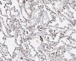 GPNMB Antibody in Immunohistochemistry (Paraffin) (IHC (P))