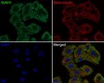 SIAH1 Antibody in Immunocytochemistry (ICC/IF)