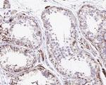 SIAH1 Antibody in Immunohistochemistry (Paraffin) (IHC (P))