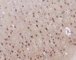 SIAH1 Antibody in Immunohistochemistry (Paraffin) (IHC (P))