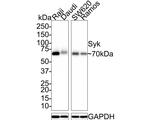 Syk Antibody in Western Blot (WB)