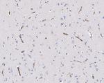 VISTA Antibody in Immunohistochemistry (Paraffin) (IHC (P))