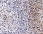 VISTA Antibody in Immunohistochemistry (Paraffin) (IHC (P))