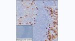 Kappa Light Chain Antibody in Immunohistochemistry (Paraffin) (IHC (P))