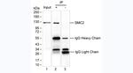 Acetyl-SMC2 (Lys114) Antibody in Immunoprecipitation (IP)