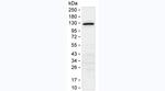 Acetyl-SMC2 (Lys114) Antibody in Western Blot (WB)