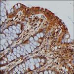 ENO1 Antibody in Immunohistochemistry (Paraffin) (IHC (P))