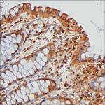 ENO1 Antibody in Immunohistochemistry (Paraffin) (IHC (P))