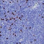 Human IgG4 Antibody in Immunohistochemistry (Paraffin) (IHC (P))