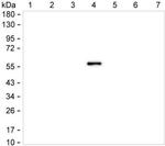 Human IgG4 Antibody in Western Blot (WB)