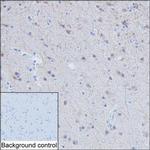 RAB11B Antibody in Immunohistochemistry (Paraffin) (IHC (P))