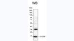 G-CSF Antibody in Western Blot (WB)