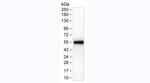 CTLA-4 Antibody in Western Blot (WB)