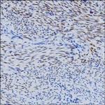 FGF2 Antibody in Immunohistochemistry (Paraffin) (IHC (P))