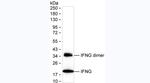 GM-CSF Antibody in ELISA (ELISA)