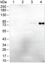 Human IgE Antibody in Western Blot (WB)