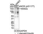 Phospho-eNOS (Ser1177) Antibody in Western Blot (WB)