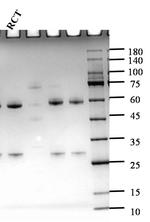 Ractopamine Antibody in SDS-PAGE (SDS-PAGE)