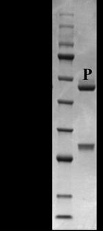 Progesterone Antibody in SDS-PAGE (SDS-PAGE)