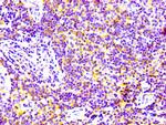 CD97 Antibody in Immunohistochemistry (Paraffin) (IHC (P))