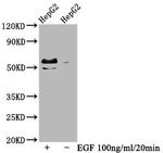 Phospho-c-Myc (Thr58, Ser62) Antibody in Western Blot (WB)