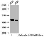 Phospho-IkB alpha (Ser32) Antibody in Western Blot (WB)