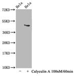 Phospho-Tau (Thr231) Antibody in Western Blot (WB)