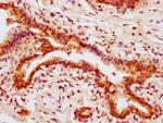 Phospho-AKT1 (Ser473) Antibody in Immunohistochemistry (Paraffin) (IHC (P))