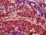 Phospho-AKT1 (Ser473) Antibody in Immunohistochemistry (Paraffin) (IHC (P))