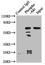 Phospho-AKT1 (Ser473) Antibody in Immunoprecipitation (IP)