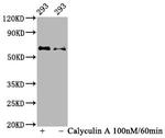 Phospho-AKT1 (Ser473) Antibody in Western Blot (WB)