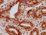 Phospho-CREB (Ser133) Antibody in Immunohistochemistry (Paraffin) (IHC (P))