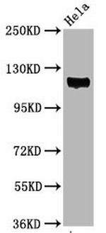 Phospho-FAK (Tyr397) Antibody in Western Blot (WB)