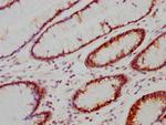 Carbonic Anhydrase IX Antibody in Immunohistochemistry (Paraffin) (IHC (P))