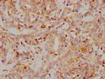 Carbonic Anhydrase IX Antibody in Immunohistochemistry (Paraffin) (IHC (P))