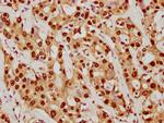 SUMO1 Antibody in Immunohistochemistry (Paraffin) (IHC (P))